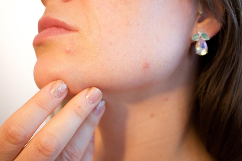 Skincare Facial Treatment